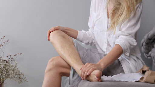 Woman sitting on a couch, shaving her leg with a razor. Flowers in the background.. blood clot image
